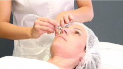 weelko microdermabrasion